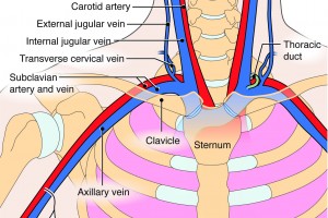 Supraclavicular vs. infraclavicular: which to use for subclavian lines with POCUS?